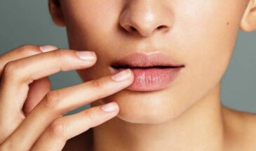 Эту зимнюю привычку делают все — а она заставляет губы трескаться, болеть и даже кровоточить