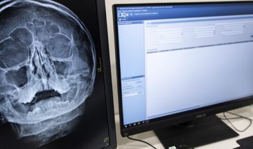 Дыра в носу и «свист» при дыхании: врач разоблачил миф о странных последствиях COVID-19 спустя годы